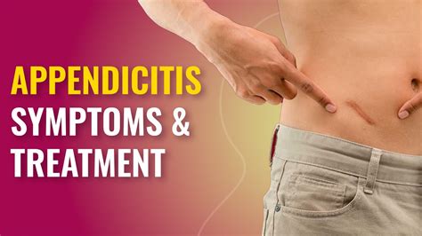 How painful is appendicitis?